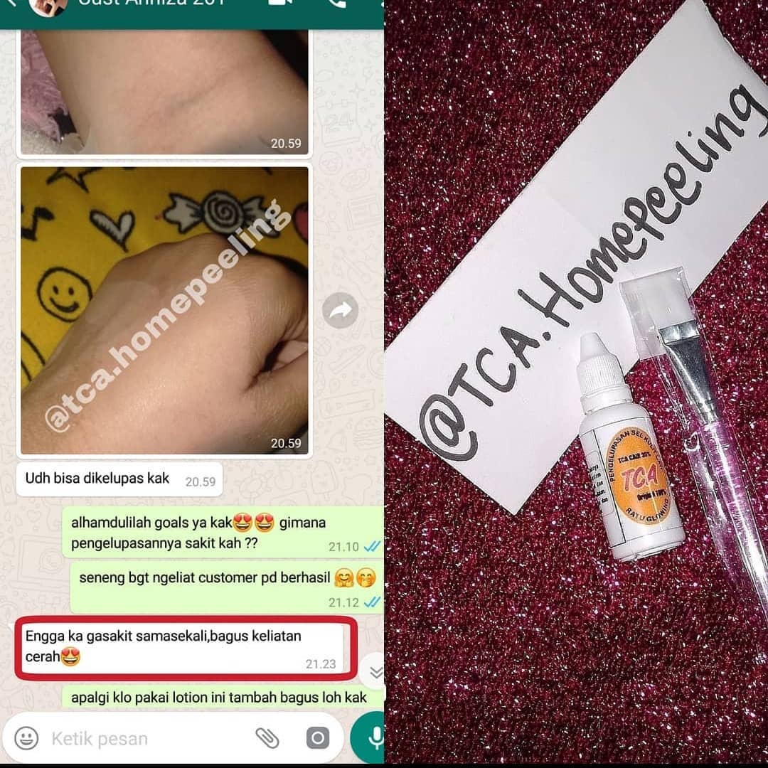 No PHP deh
Udah perwatan mahal dimana mana tapi ga mempan coba deh pakai TCA peeling ini