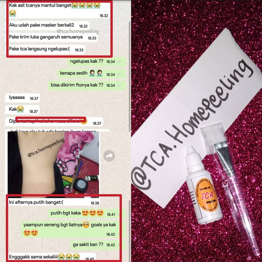 Memang usaha ga menghianati hasil, yg masih ragu sunggug meRUGI
