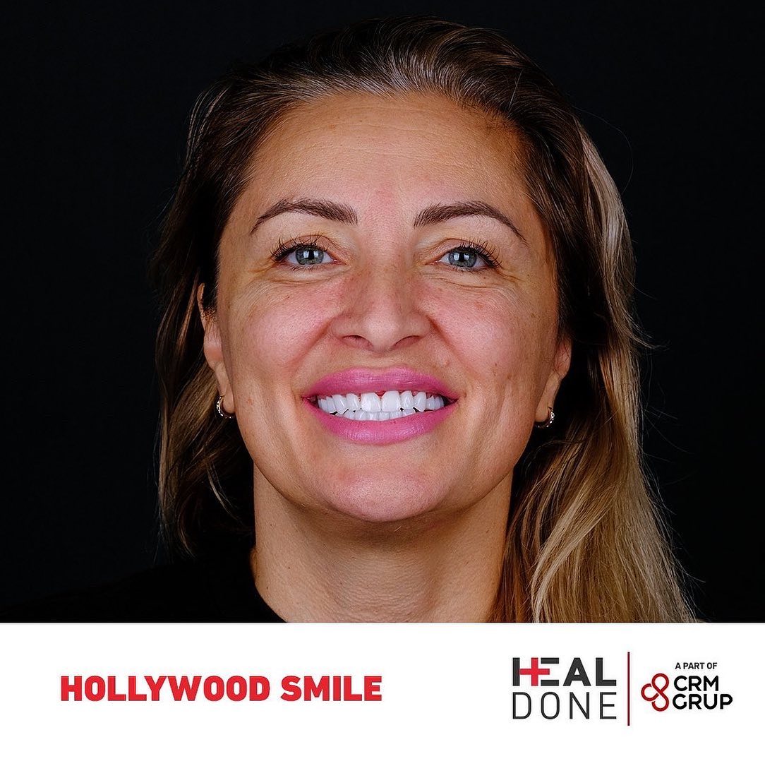 Nos dents sont les éléments les plus visibles de notre visage. Obtenez vos dents blanches parfaites avec Heal Done.
Contactez-nous.
📞 +90 542 125 35 00
#hollywoodsmile #turkey #istanbul #implantsdentaires #turquie #traitementsdentaires