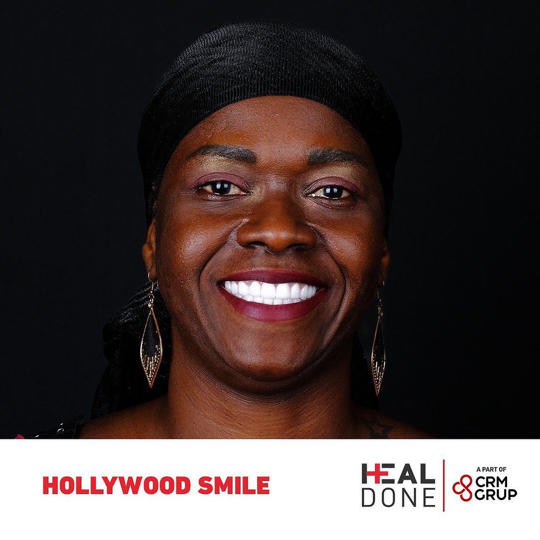 Une nouvelle forme du sourire c'est le premier pas vers un avenir meilleur.
Contactez-nous.
📞 +90 542 125 35 00
#hollywoodsmile #turkey #istanbul #implantsdentaires #turquie #traitementsdentaires