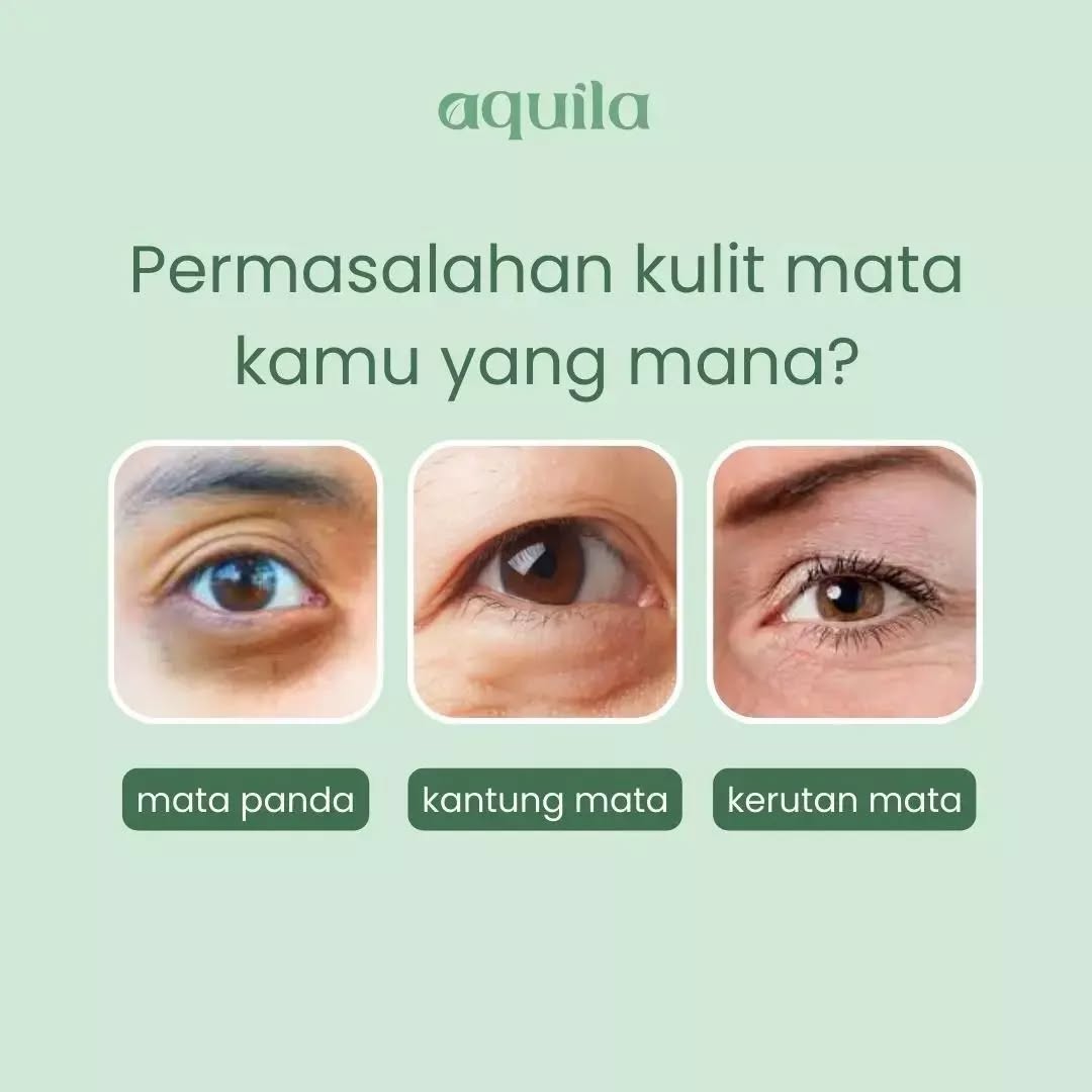 Permasalahan kulit mata kamu yang mana Qilababes?
Komen dibawah ya🙆♀️
#Aquila #Aquilaherb #skincarenatural #skincareorganik #kantungmata #darkcircles #kerutan #matapanda