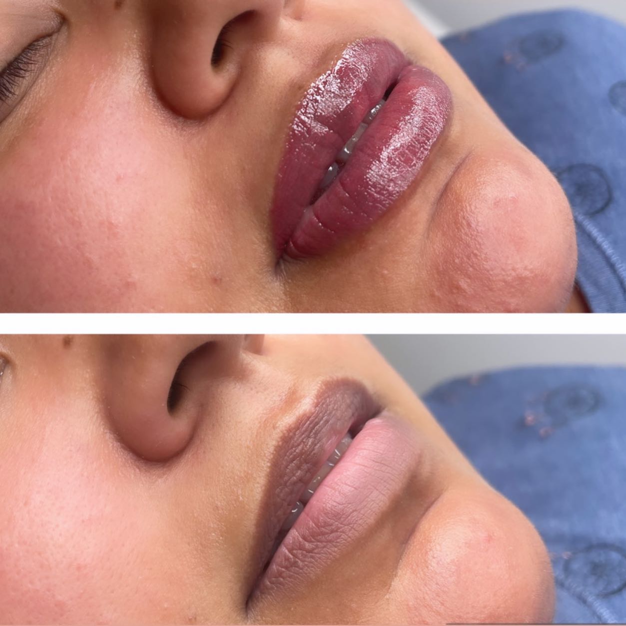 Book your lipblush appointment now!!Creating a natural lip blush takes great expertise and super-honed skills, as well as using the correct pressure💋 #lipblush#lipblushtattoo#london#beauty#whetstone#lithopsbeauty#whetstone#lipblushtattoo