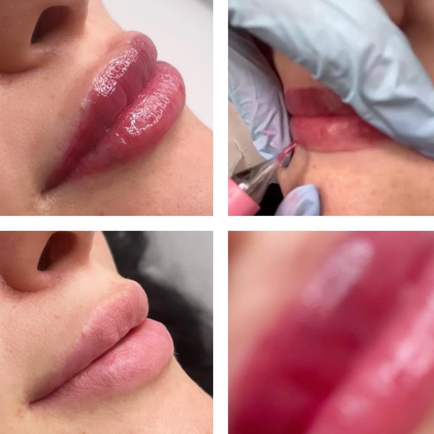 Lithops Lipblush💋 Book Now!!💋#facialtreatment#facials#beautytips#beautybloggers#semipermanentmakeup#semipermenanteyeliner#lithopsbeauty#bbglowlondon#beautybloggers#beautytips#beautysalon#facialtreatment#facials#facialskincare#whetstones#totteridgeandwhetstone#londonbeauty#lipcolour#semipermanentbrows#microbladinglondon#bbglowtreatment##cellulitetreatment#cellulite#london#whetstone#mummymakeover#lipblush