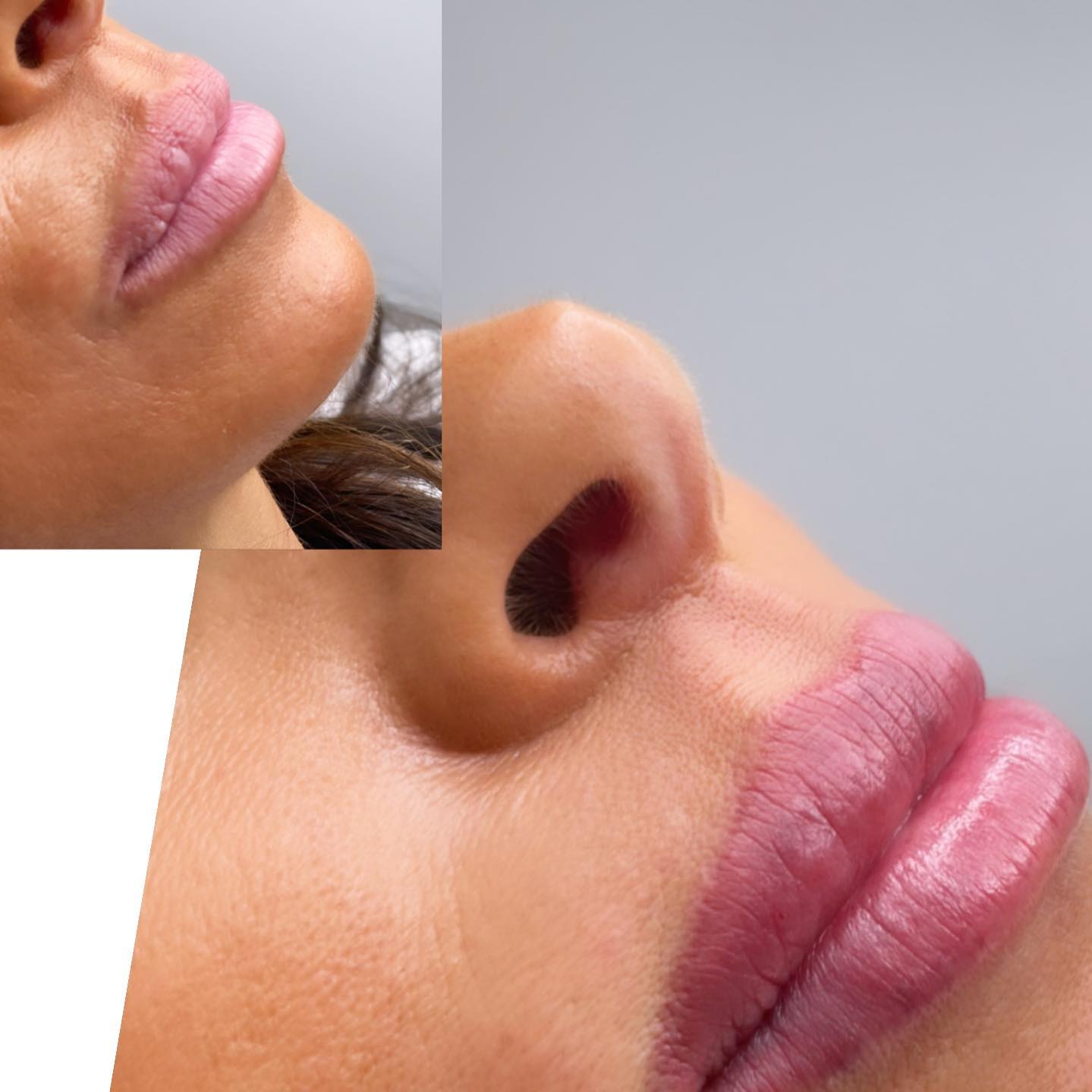 Lithops Lipblush💋 Book Now!!💋#facialtreatment#facials#beautytips#beautybloggers#semipermanentmakeup#semipermenanteyeliner#lithopsbeauty#bbglowlondon#beautybloggers#beautytips#beautysalon#facialtreatment#facials#facialskincare#whetstones#totteridgeandwhetstone#londonbeauty#lipcolour#semipermanentbrows#microbladinglondon#bbglowtreatment##cellulitetreatment#cellulite#london#whetstone#mummymakeover#lipblush