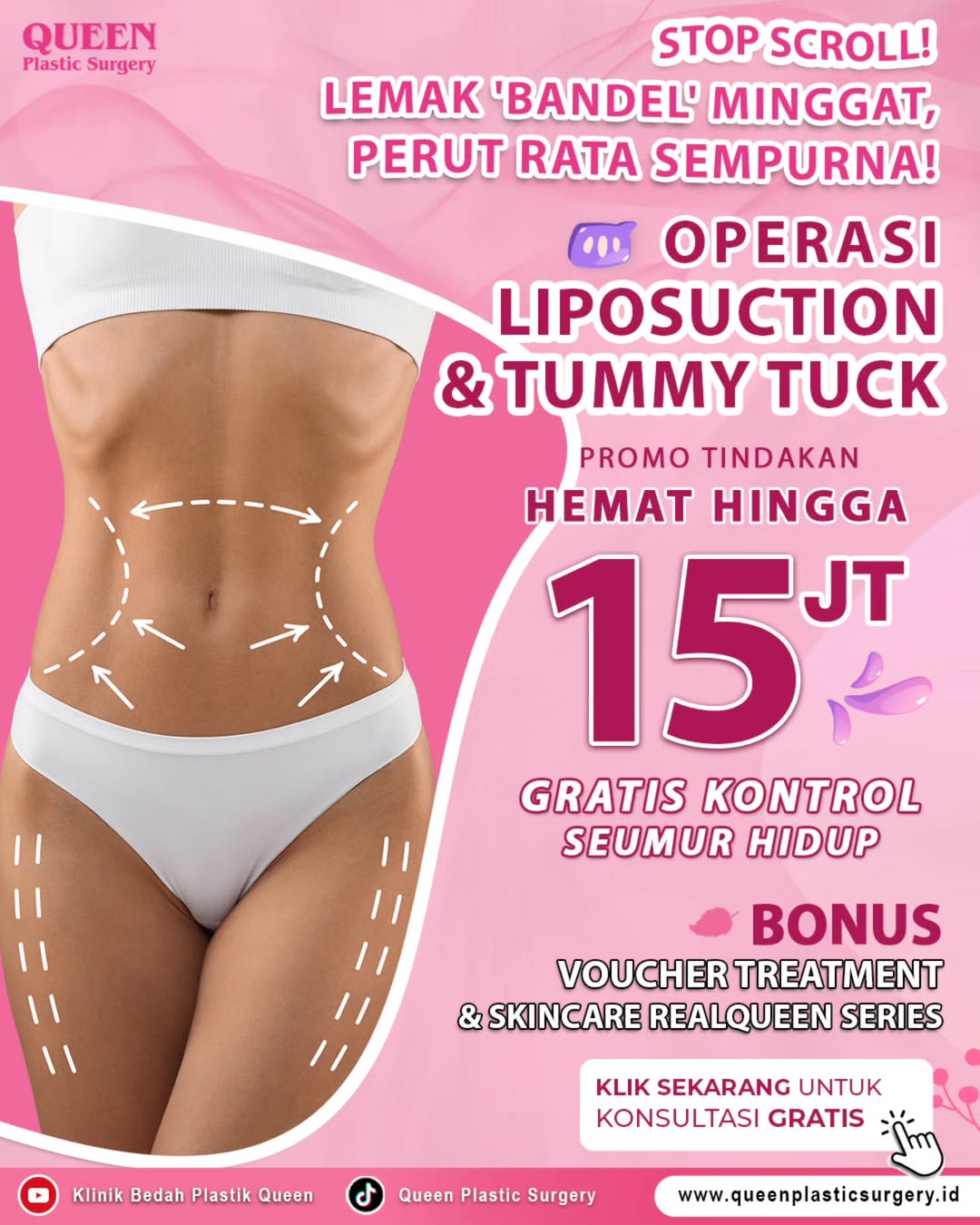 STOP SCROLL! Wujudkan Perut Rata Impianmu dengan Promo Liposuction & Tummy Tuck!
Capek dengan lemak 'bandel' di perut dan pinggang yang susah hilang? Ingin punya perut rata dan body goals yang sempurna? Queen Plastic Surgery punya solusinya!
Dapatkan promo spesial untuk tindakan Liposuction (Sedot Lemak) dan Tummy Tuck (Pengencangan Perut)! Kombinasi ampuh ini akan menghilangkan lemak berlebih dan mengencangkan otot perut yang kendur, menciptakan siluet tubuh yang lebih ideal dan menawan.
HEMAT HINGGA Rp 15 JUTA!
Jangan lewatkan juga GRATIS KONTROL SEUMUR HIDUP serta BONUS VOUCHER TREATMENT & SKINCARE REALQUEEN SERIES untuk hasil yang maksimal dan perawatan pasca-operasi yang nyaman.
Saatnya ucapkan selamat tinggal pada perut buncit dan sambut penampilan baru yang lebih percaya diri!
KLIK LINK DI BIO SEKARANG UNTUK KONSULTASI GRATIS!
Atau langsung DM kami untuk informasi lebih lanjut.
📍 Kunjungi Klinik Bedah Plastik Queen
#Liposuction #SedotLemak #TummyTuck #OperasiPlastikPerut #PerutRata #BodyGoals #KlinikKecantikanJakarta #QueenPlasticSurgery #BedahPlastikJakarta #Langsing #BebasLemak #PromoKecantikan #TransformasiTubuh #KecantikanIndonesia #EstetikaTubuh #PerawatanTubuh #ConfidentBody